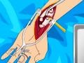 Тоглоом Arm surgery 2