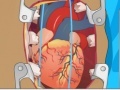Тоглоом Heart Surgery