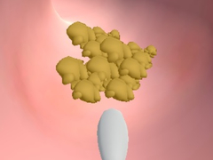 Тоглоом Earwax Clinic